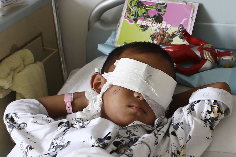 un enfant de 6 ans se fait voler les yeux en Chine