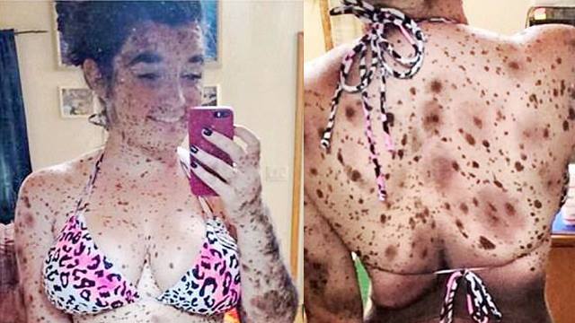 Tsvetotip lété avec les taches de rousseur de la photo