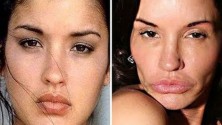 Chirurgie esthétique: ça ne pouvait pas être pire