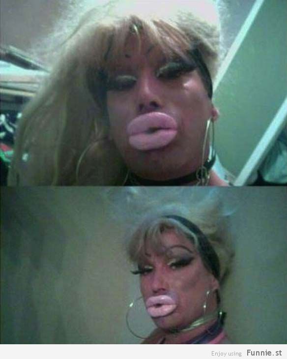the_horrors_of_terrible_plastic_surgery_640_high_26