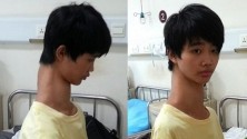 Fu Wengui, le garçon girafe au cou anormalement long