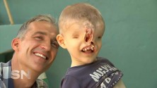 Yahya El Jabaly, le petit marocain sans visage sera bientôt opéré