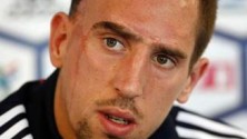 A quoi ressemblerait Franck Ribéry sans cicatrices ?