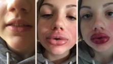 Kylie Jenner Challenge : le nouveau défi social pour se gonfler les lèvres