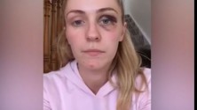 Un témoignage bouleversant d&rsquo;une jeune maman battue par son compagnon
