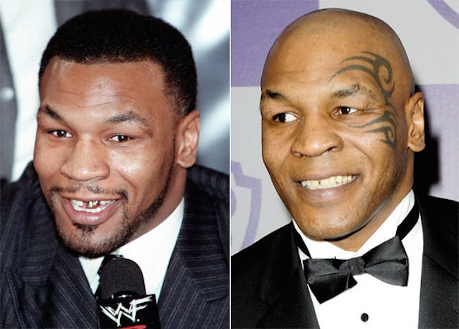Credit: Levy, Djansezian/Getty Original Filename: gal_teeth_mike-tyson.jpg