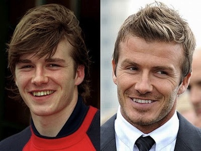 12-photos-des-dents-de-stars-avant-et-apres-une-bonne-chirurgie-dentaire3