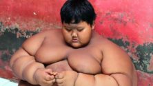 L’enfant le plus obèse du monde a 10 ans et pèse 192 kilos