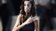 Désapprouvée sur son physique, Lizzie Velasquez adresse un message de paix à ses détracteurs