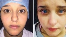 Vous pouvez désormais changer la couleur de vos yeux d&rsquo;une façon permanente à 18.000 dhs