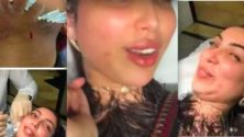 Dounia Batma enflamme la toile avec « des injections au visage »
