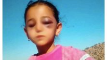 Une petite fille marocaine vient d’être violemment agressée…