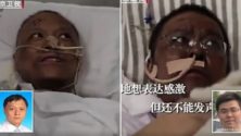 La couleur de peau de deux médecins chinois atteints du Coronavirus a changé…