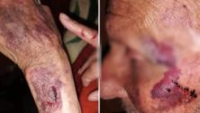 En plein confinement, un vieil homme aurait été agressé par un agent d&rsquo;autorité dans la région de Casablanca