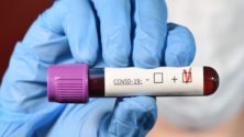 77 nouvelles contaminations enregistrées au Maroc