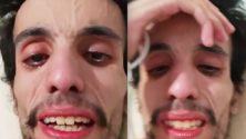 Vidéo : Ce jeune marocain souffre et demande votre aide