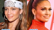 Photos : 20 ans plus tard… Ces stars qui ne vieillissent pas 