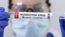 Les trois cas suspects de variole du singe au Maroc sont négatifs