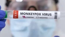 Mpox ou Variole du Singe : Ce qu’il faut savoir !